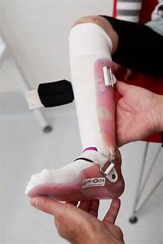 Orthopaedic Socks